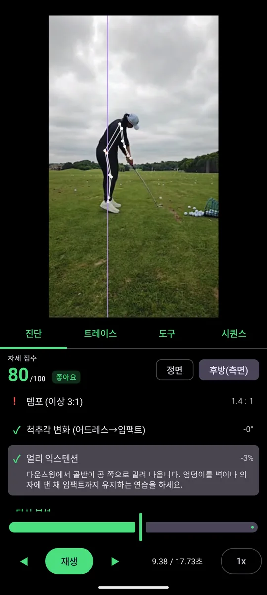 자세 진단 — 점수, 항목별 판정, 문제 부위 강조